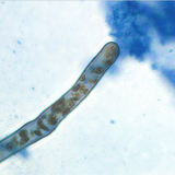 Rhizophagy