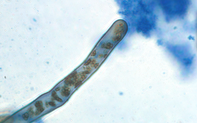Rhizophagy