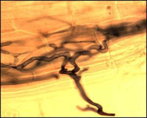 microscopic view of a mycorrhizal fungi inserted into the root of a plant.